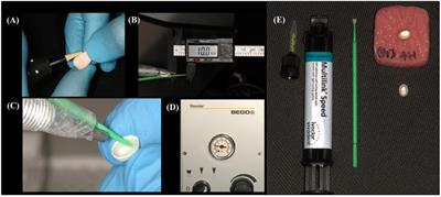 Effect of air-particle abrasion and methacryloyloxydecyl phosphate primer on fracture load of thin zirconia crowns: an in vitro study